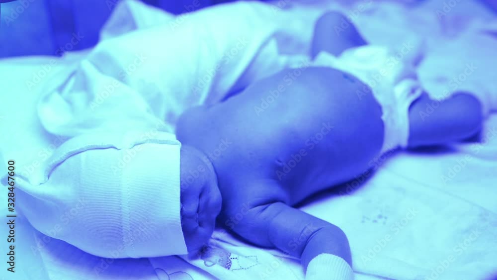 Newborn having a treatment for jaundice under ultraviolet light, Baby