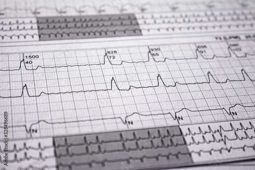 Photos Heartbeat represented on paper