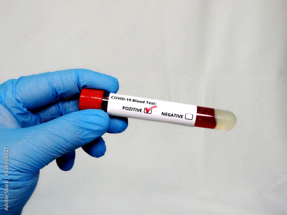 Obraz premium Blood test, Covid-19, China Wuhan Coronavirus