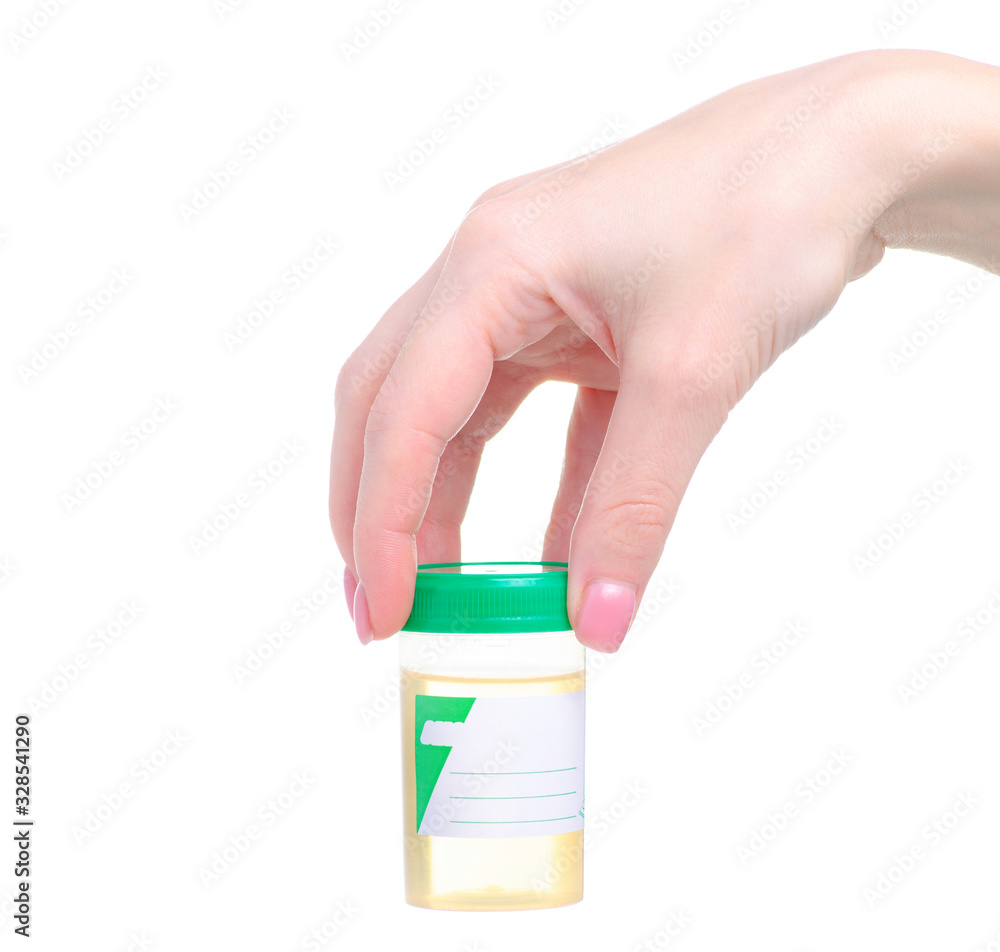 Container for urine analysis object in hand on white background isolation Container for urine analysis object in hand on white background isolation
