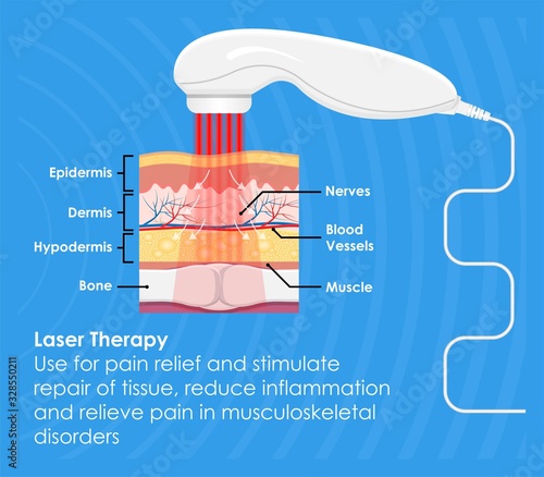 Laser Pain Therapy Handheld Portable Electronic Device for Relief Pain