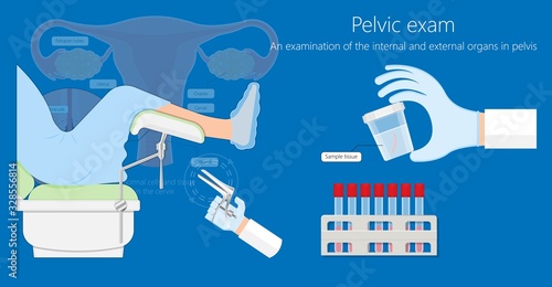 Cold knife cone biopsy Loop Electrosurgical Excision Procedure LEEP Large Loop Excision of the Transformation Zone LLETZ remove tissue from the cervix for precancerous cell laser diathermy per treat