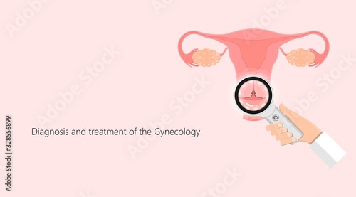 Cold knife cone biopsy Loop Electrosurgical Excision Procedure LEEP Large Loop Excision of the Transformation Zone LLETZ remove tissue from the cervix for precancerous cell laser diathermy per treat