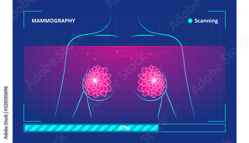 Vector illustration of the process of low-energy X-rays use in human breast examination
