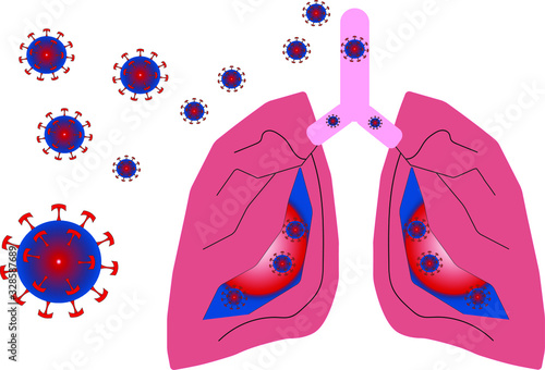 Coronavirus (COVID-19) attacking penetrates the lungs causes pneumonia