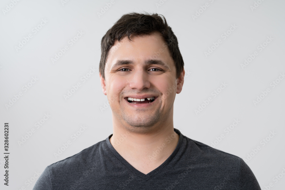 Man With Missing Tooth Stock Photo | Adobe Stock