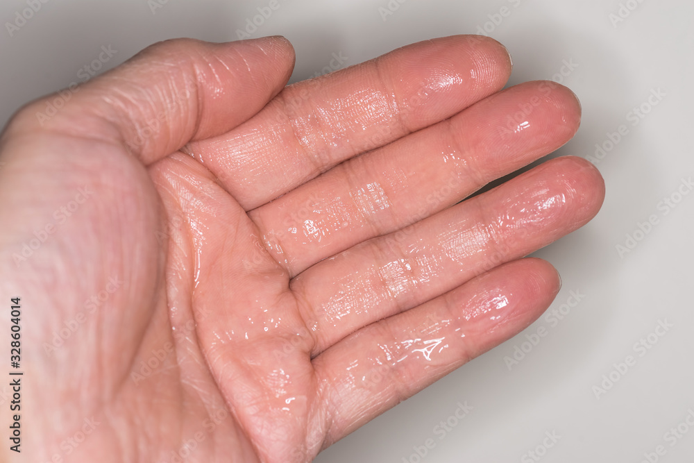 Hand covered with anti-bacterial hand gel. Spread over fingers and palm. Health and hygiene to kill virus and germs. Hand covered with anti-bacterial hand gel. Spread over fingers and palm. Health and hygiene to kill virus and germs.