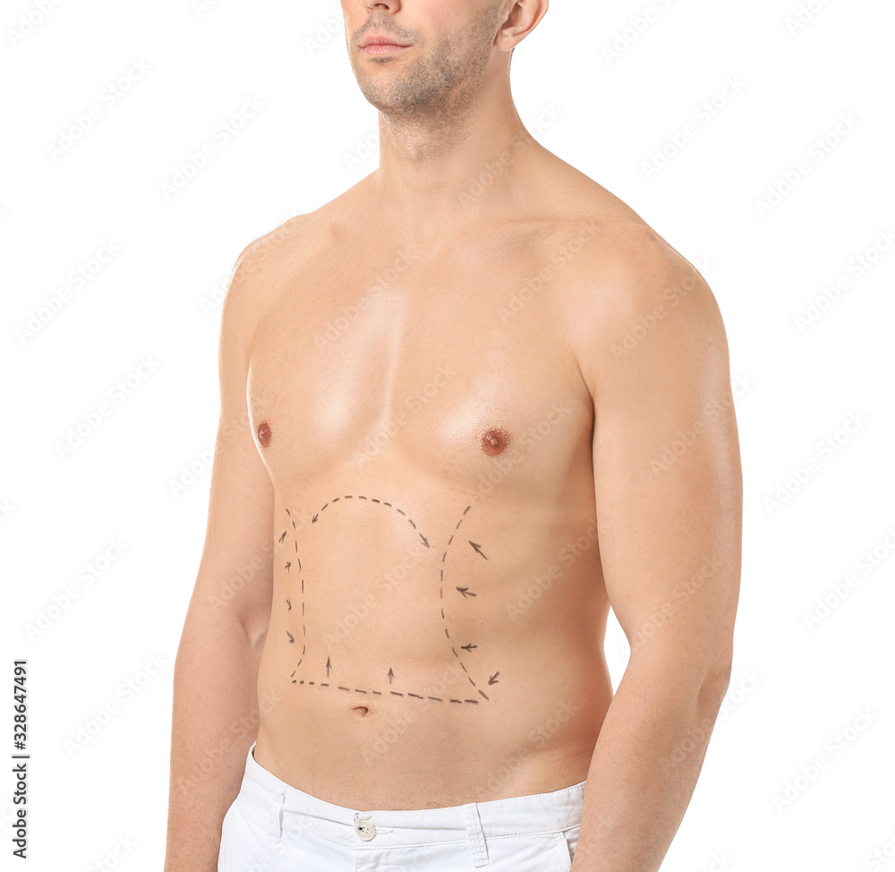 Fototapeta premium Young man with marks on his body against white background. Concept of plastic surgery