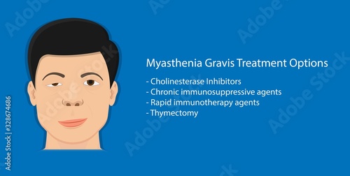 Myasthenia gravis (MG) disease treatment diagnosis testing Electroneuromyography Bell’s palsy Electromyogram problem muscular Motor Carpal tunnel syndrome Cubital Guillain Barre Peripheral neuropathy