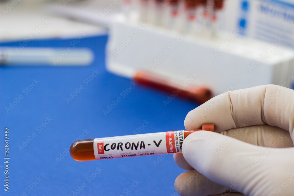 Obraz premium blood test tube to examine the corona virus