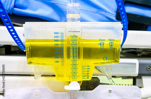 Urine output measurement device scale.