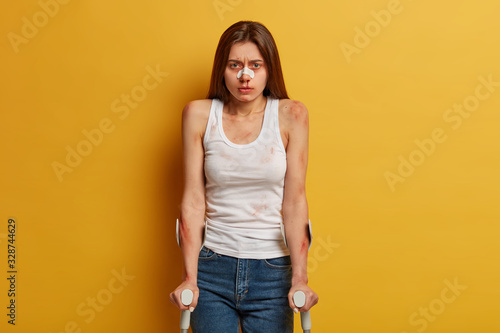 Tired hurt woman got trauma, being injured after recovery, has surgery rehabilitation, bleeding nose, spends time at home on sick leave, disabled to walk, isolated on yellow wall. Limited abilities
