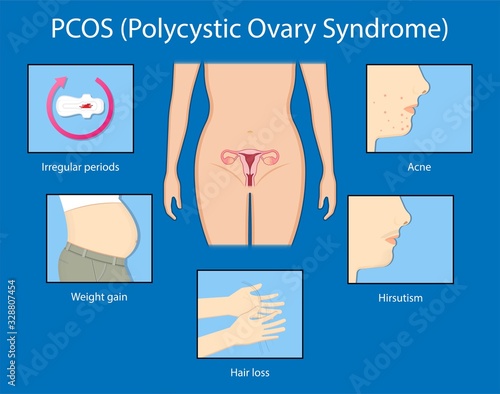 polycystic ovary syndrome PCOS hormonal diagnose diagnostic exam abnormal cancer fertility cysts physical organs blood transducer probe abdominal bleeding pain ectopic pregnancy uterine