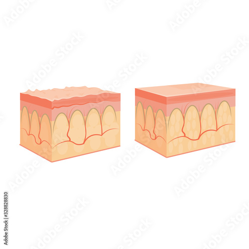 wrinkle and normal skin cross-section of human skin layers structure skincare medical concept flat vector illustration