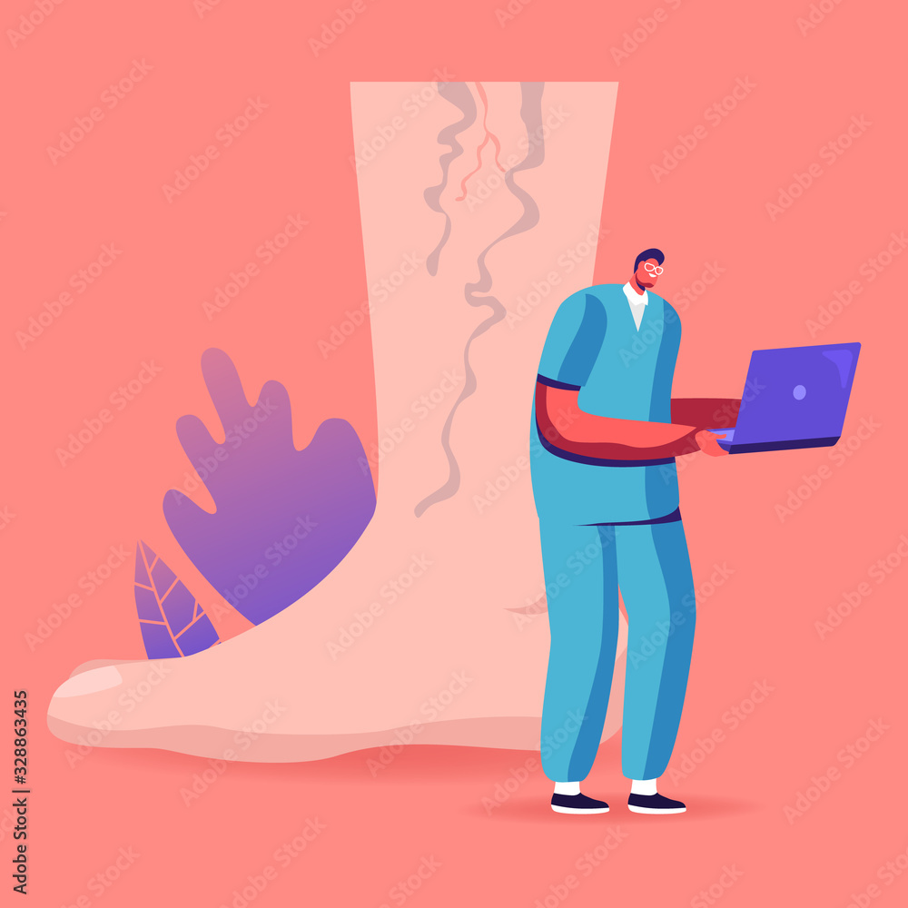 Feet Health Care, Podiatry Concept. Tiny Doctor Character Working on Laptop  at Huge Foot with Diseased Spider Veins Searching Info about Thrombosis and  Varicose Treatment. Cartoon Vector Illustration Stock Vector | Adobe