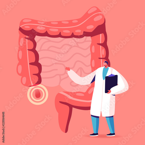 Doctor or Medical Teacher Character Stand at Human Intestines with Sore Appendix Infographics Decide Strategy of Treatment. Abdominal Pain, Gastrointestinal System Disease. Cartoon Vector Illustration