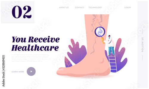 Vein Thrombosis, Varicose Treatment Landing Page Template. Tiny Doctor Character Stand on Ladder with Magnifying Glass Looking on Huge Foot with Diseased Veins, Podiatry. Cartoon Vector Illustration