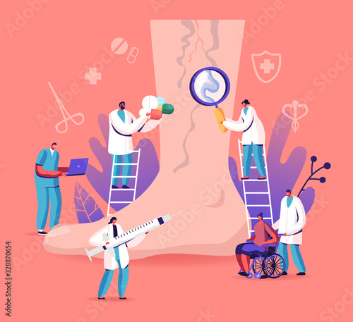 Vein Thrombosis and Varicose Treatment Concept. Tiny Doctor Characters with Medical Instruments and Drugs around of Huge Foot with Diseased Veins, Health Care. Cartoon People Vector Illustration