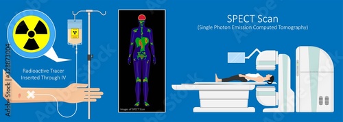 SPECT scan radiologist single computed image CT PET 3D radiotracer Radioiodine I-131 examines uptake treat iodine radiology radioactive diagnosis diagnose radioisotopes radiopharmaceuticals