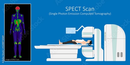 SPECT scan radiologist single computed image CT PET 3D radiotracer Radioiodine I-131 examines uptake treat iodine radiology radioactive diagnosis diagnose radioisotopes radiopharmaceuticals