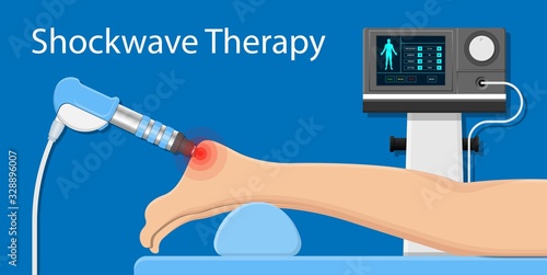 Shockwave therapy SWT physiotherapist treat muscular disorder back neck physical tennis Elbow muscle stimulator ultrasound calcific tendonitis