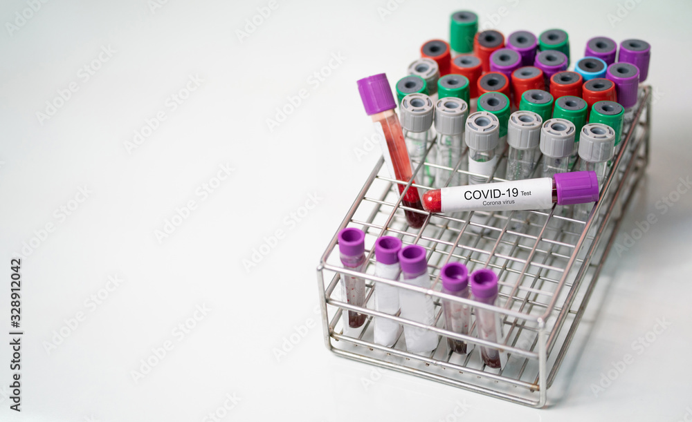 Test tube with blood sample for COVID-19 test, novel coronavirus 2019 found in Wuhan, China Test tube with blood sample for COVID-19 test, novel coronavirus 2019 found in Wuhan, China