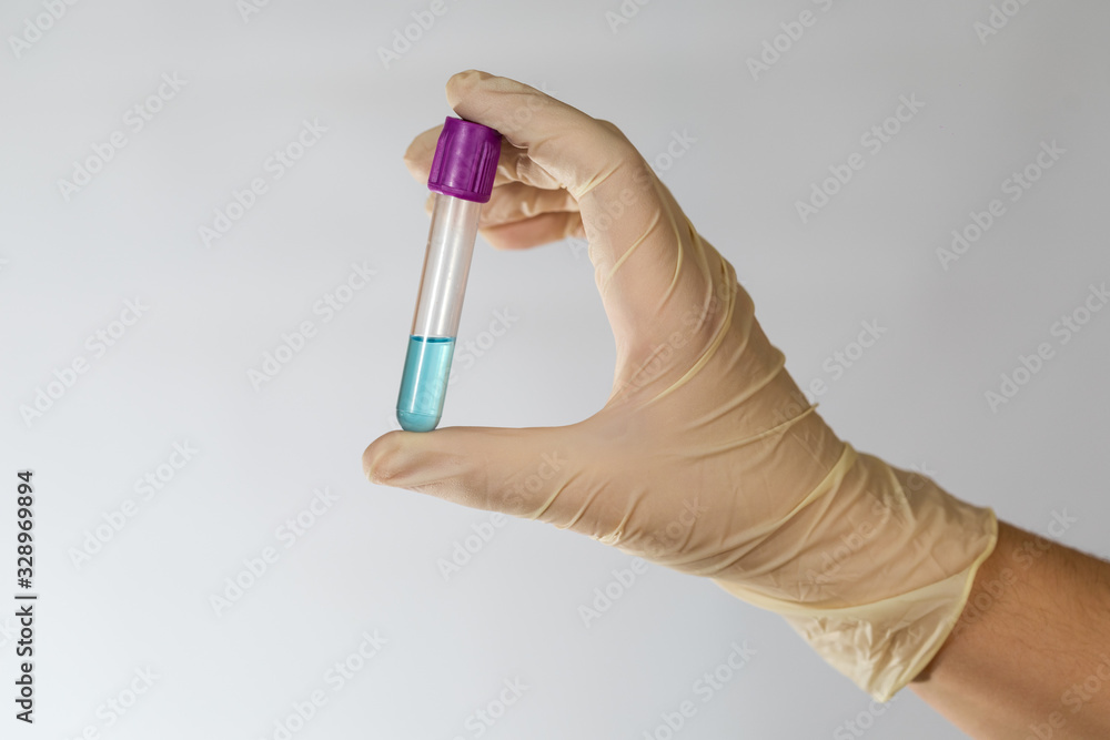 Test tube with blue transparent chemical fluid in the hands of a scientist. Hands in latex gloves. Vacuum test tube. Test tube with blue transparent chemical fluid in the hands of a scientist. Hands in latex gloves. Vacuum test tube.