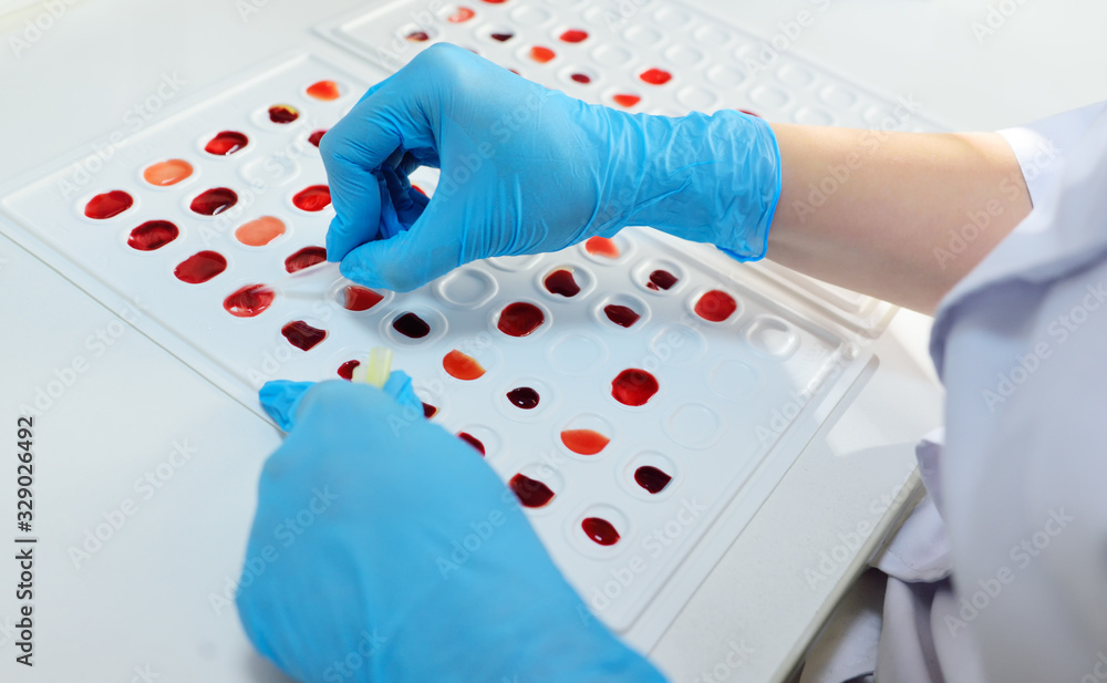 medical laboratory worker holds cuvette for definition of blood type and Rh factor. foto de