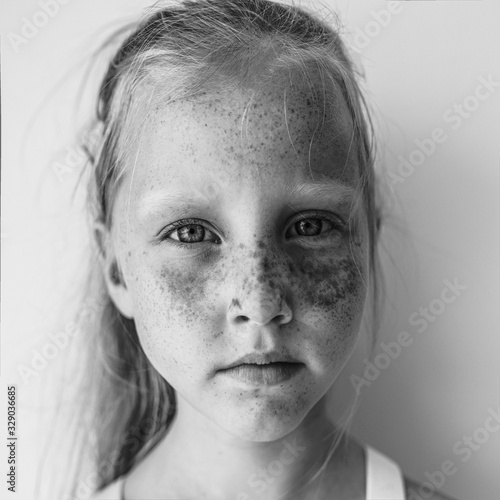 Little ginger girl with pigment on her face and freckles. Children's portrait. Not like everyone else. Interesting appearance.