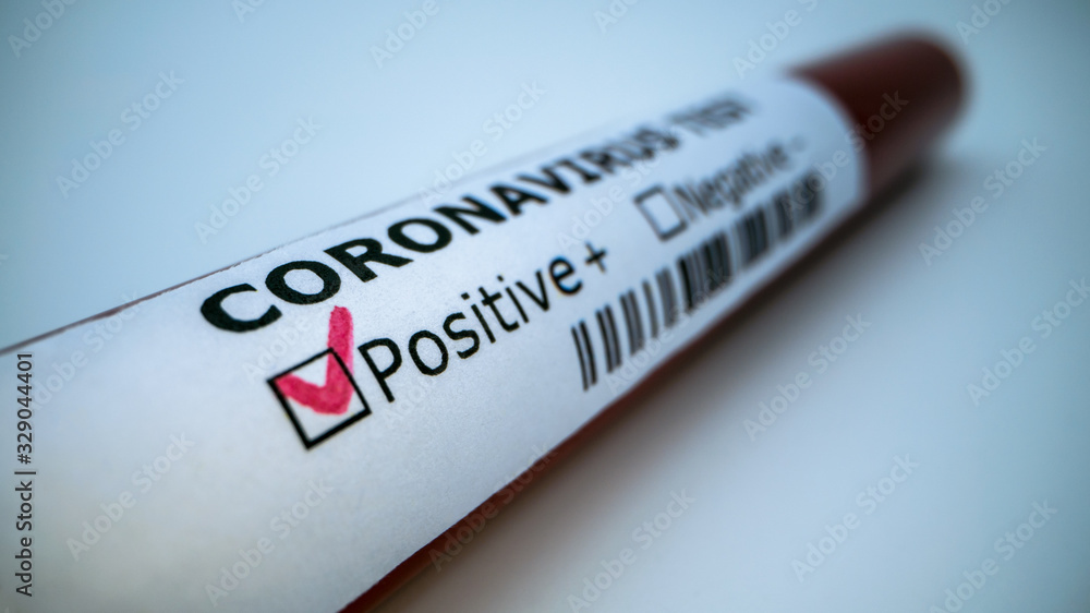 Positive COVID-19 test. Laboratory sample of blood testing for infection Positive COVID-19 test. Laboratory sample of blood testing for infection
