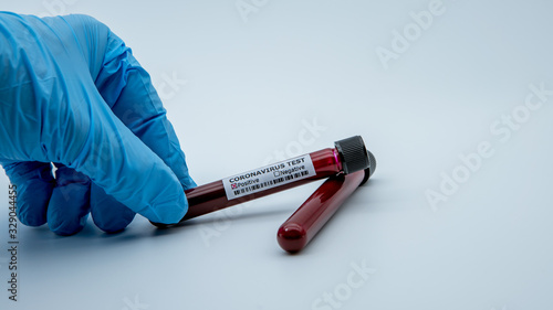 Test tube with infected blood sample for COVID-19, coronavirus from Wuhan
