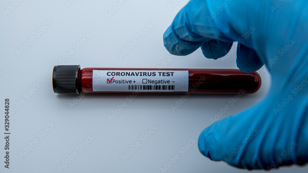 Fototapeta premium Test tube with infected blood sample for COVID-19, coronavirus from Wuhan
