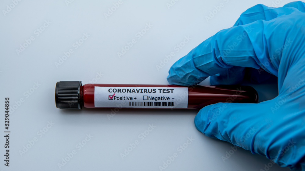 Obraz premium Surgical gloves with a positive coronavirus infected blood sample test.
