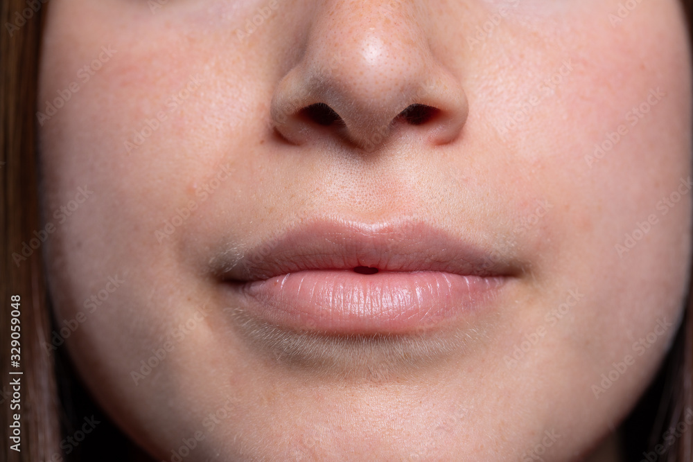 Close up of young female mouth skin care beauty routine concept Close up of young female mouth skin care beauty routine concept