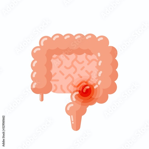 Flat vector illustration of sick human intestine, cartoon style illustration