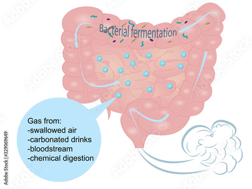 Bloating and excess gas in intestine vector illustration isolated on a white background