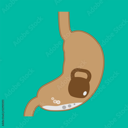 Vector image of a human stomach. Stomach in section with a kettlebell. Heaviness in the stomach. To advertise treatment products