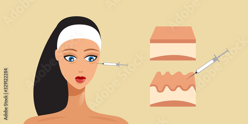 hyaluronic acid facial injection skin layer beauty cosmetology anti-aging female rejuvenating mesotherapy concept portrait horizontal vector illustration
