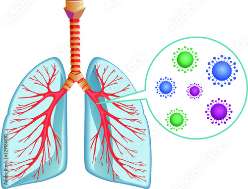Ilustración vectorial sobre fondo blanco. Pulmones y virus
