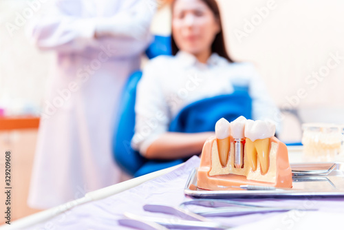 Dentist with tooth implant false teeth. Dentistry and healthcare concept at dental clinic.