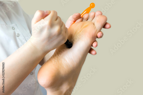Manual foot massage.