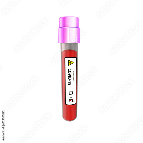 Blood test 4K COVID 19 Coronavirus outbreak microscope animation .2019 ncov background. virus dangerous. flu alert