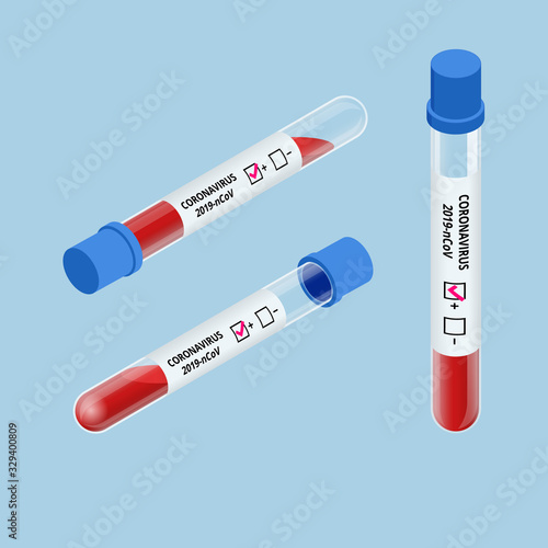Isometric express test for COVID-19. Information Coronavirus Disease 2019 COVID-19