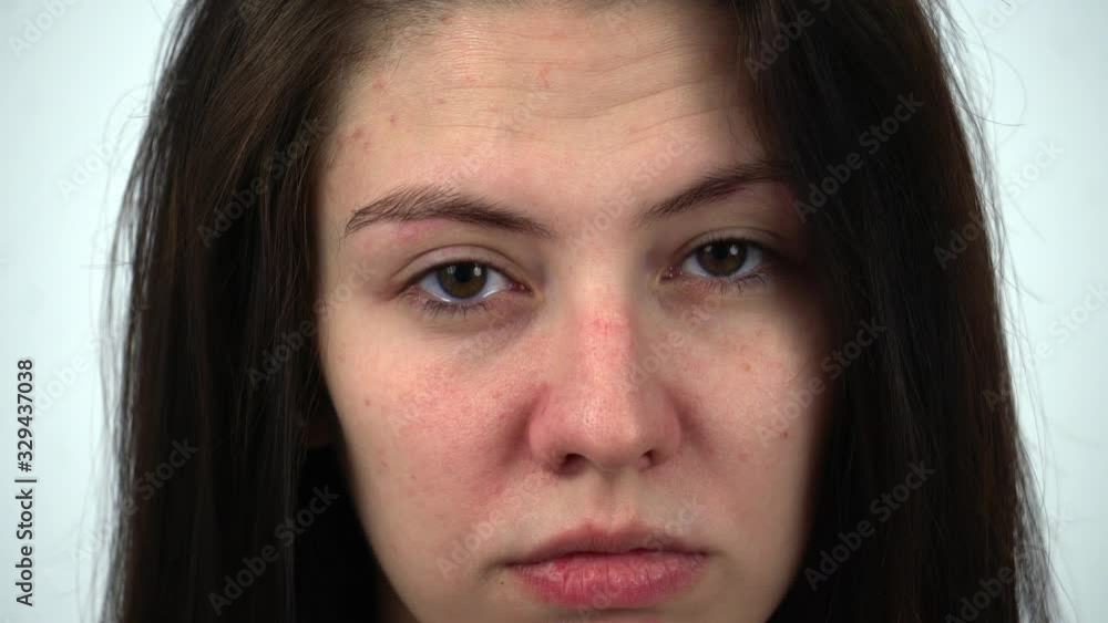 Girl inserts a transparent lens into her eye and blinks. close-up Girl inserts a transparent lens into her eye and blinks. close-up