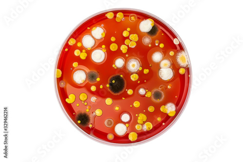 Petri dish with mixed of bacteria colonies photo
