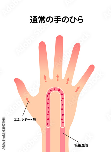通常の健康な手のイラスト (冷え性の原因) 