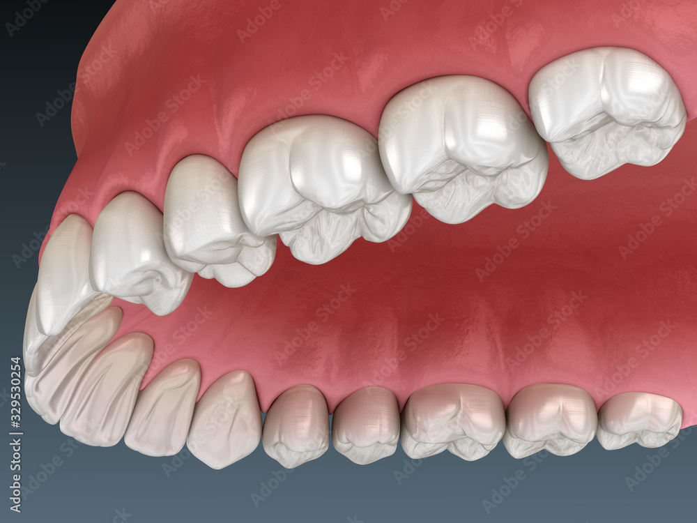 Fototapeta premium Maxillary human gum and teeth. Medically accurate tooth 3D illustration
