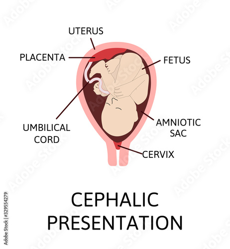 Different baby positions in the uterus during pregnancy.