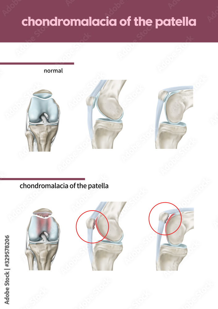 메디컬일러스트 Stock Illustration | Adobe Stock