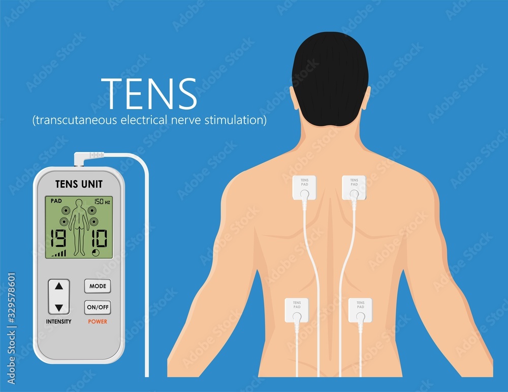 Digital TENS Transcutaneous Electrical Nerve Stimulation Relax Patient Body  Pain Relief Stiffness Muscle Massage Acupuncture Therapy Machine Electro  Stock Vector